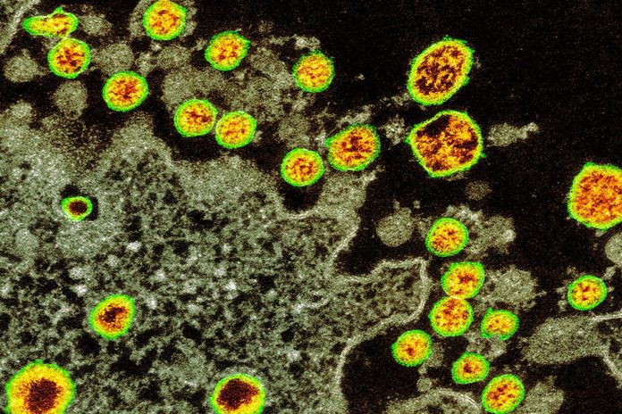c0482483-covid-19_coronavirus_tem_web