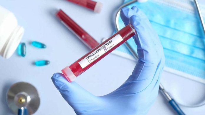 koronavirus-test-pozitiv-1536x864