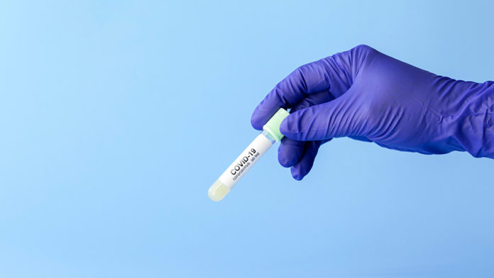 Coronavirus-Self-tester-available-as-of-today-in-Serbia-1