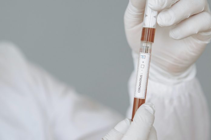 person-holding-test-tube-and-syringe-4149042-scaled