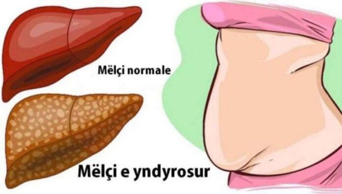 melci-770x437