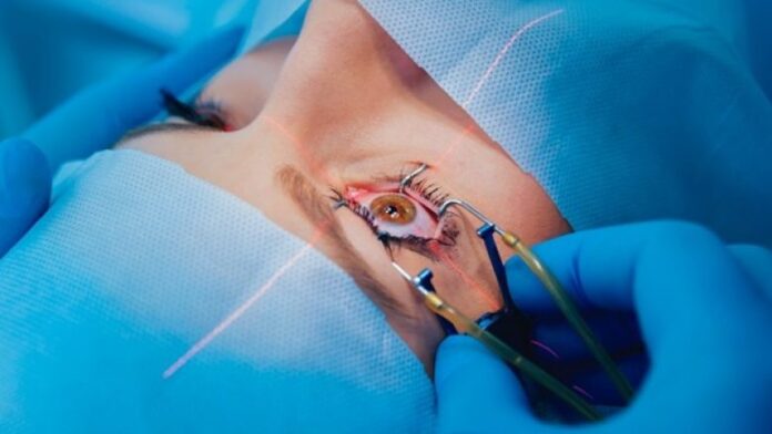 LASIK-teaser-780x439