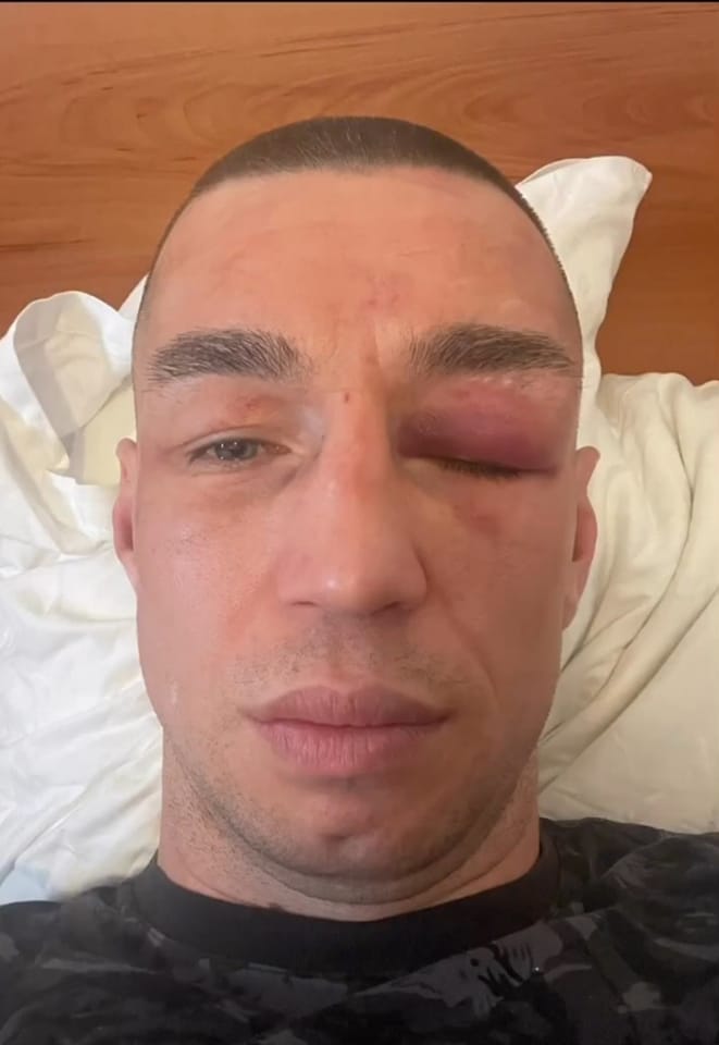S’po sheh, boksierit serb i mbyllet syri nga grushtet e shqiptarit Bernardin Jakaj