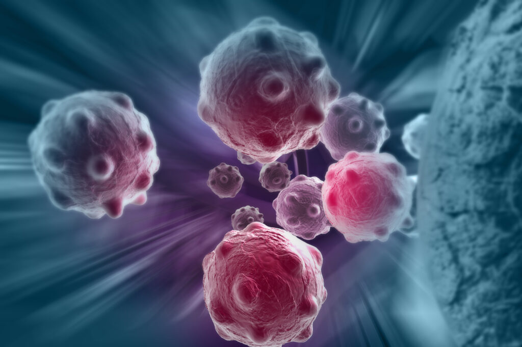Lidokainet i bëjnë qelizat e kancerit të vetëshkatërrohen, thotë një studim i ri