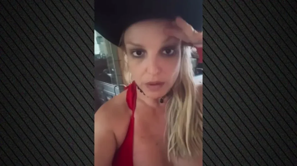 britney-spears-rrefen-pervojen-e-frikshme-pas-botoksit