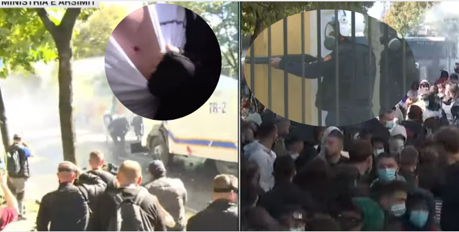 Tensione te Ministria e Arsimit në Tiranë, i riu tregon plagën: Po na gjuajnë me plumba gome